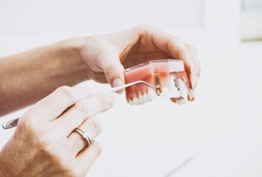 Root Canal Treatment